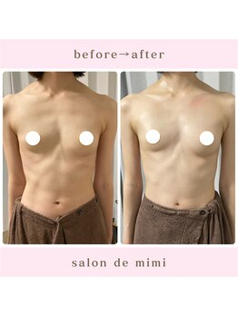 サロン ド ミミ(salon de mimi)/バストアップBeforeAfter