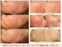 ビジュープラス 水戸店(Bijou+)の雰囲気（弱いお肌からスタートした、実際のお客様の症例を多数掲載♪）