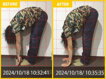 整体院 元 宇城松橋店/腰の痛みで来院