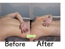 エトワール(Etoile)/筋膜リリースカッターの効果！