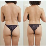 ルピナス(Lupinus)