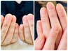 【深爪・縦筋・自爪育成専用コース】育爪ジェル＋保湿炭酸ウオーターケア付き