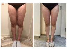 エイシスグロウ(asis glow.)/効果写真