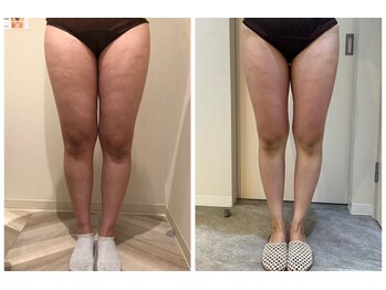 エイシスグロウ(asis glow.)/効果写真