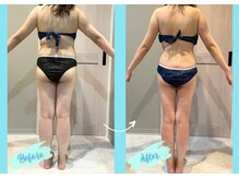 千歳の女神 西尾本店/【施術風景】Before/After