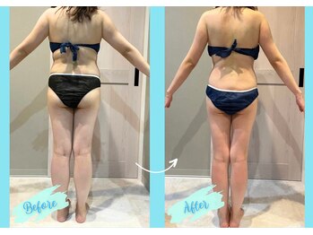 千歳の女神 西尾本店/【施術風景】Before/After