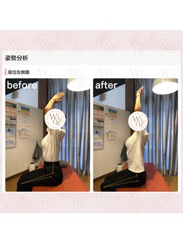 うぃず鍼灸整骨院/【施術例５】