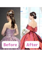 ボディキュア ブライダル美容整体 大阪梅田/ストレート首とさよなら◎/関西