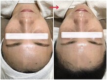 オージャス(OJAS)/40代の方　セルマン艶玉肌