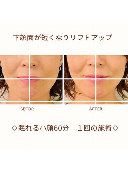 キラン 神戸店(Kiran)/一度で変わるゴットハンドの小顔