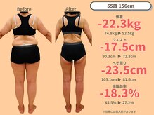 ニドム/55歳　-22kg大幅痩身ダイエット3