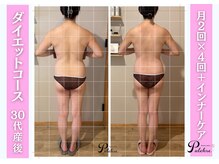 プルクレ 常磐町店(Pulchre)/ダイエットコース♪産後30代