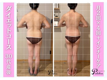 プルクレ 常磐町店(Pulchre)/ダイエットコース♪産後30代