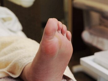 フットスタジオ アルク(FOOT STUDIO ALUK)の写真/【本町/卒業型★足ケア専門店】巻き爪や魚の目、角質、タコ等足悩みを歴15年/施術数1.5万人のアルクが解決!