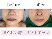 デュモンド(dumonde)の雰囲気（50代エイジングケア◎ほうれい線・たるみ・リフトアップ！！）