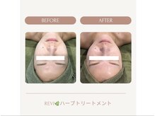 ミロワール ドゥ サピュイェ(MIROIR de Sappuyer)/★お肉が上へリフト★
