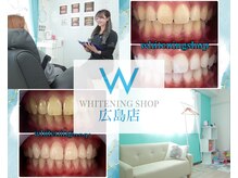 ホワイトニングショップ 広島店(WHITENING SHOP)