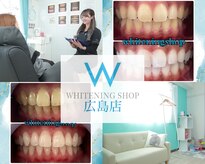 ホワイトニングショップ 広島店(WHITENING SHOP)