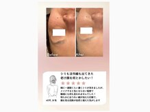 ケリー 名古屋(Kelly)の雰囲気（モヤモヤが薄くなるとお顔の印象がグッと変わります！）