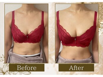 マリン(MARINE)/50代Before→After