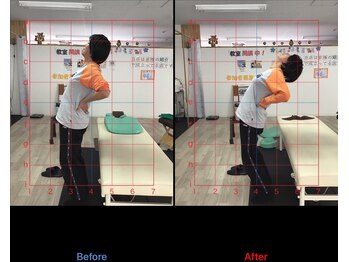 ストレチックス 近江八幡店/BeforeAfter