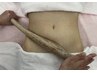 【関西希少】パワーツリーで引き締め!1箇所(お腹or脚or腕orヒップ)100分