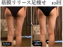 スラン(Slan)の雰囲気（美尻×美脚ラインおまかせください！むくみ知らずでスッキリ★）