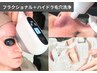 都度払い【クレ-タ-/毛穴開き/ニキビ.跡】フラクショナル+ハイドラ毛穴洗浄