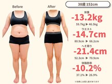 ニドム/38歳　-13kg産後痩身ダイエット1