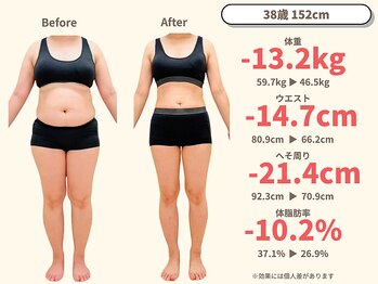 ニドム/38歳　-13kg産後痩身ダイエット1