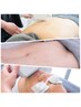 【おすすめ】全身脱毛(顔・VIO込み)¥26,000→23,000