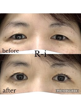 アールアイ(R-i)/アイリッドアップパーマ