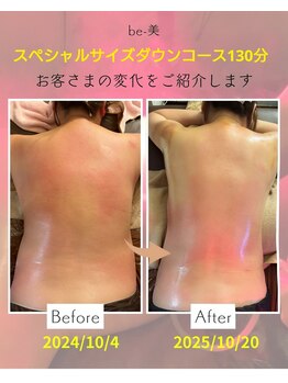 びび(be美)の写真/サイズダウンスペシャルで理想のラインへ!一度でスッキリボディを目指す贅沢ケア♪