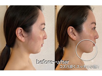 リラクゼーションエステ アジュール(Azur)の写真