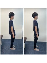 パシオン接骨院 整体院/ビフォーアフター