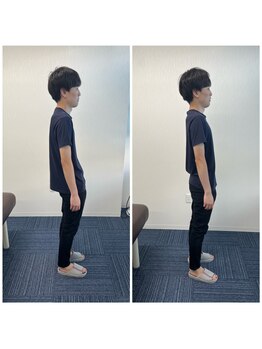 パシオン接骨院 整体院/ビフォーアフター