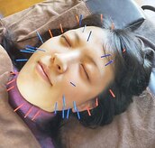 やまざき鍼灸整骨院