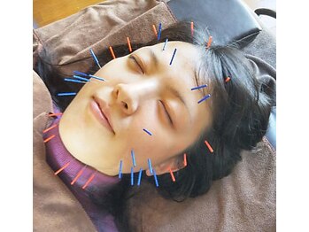 やまざき鍼灸整骨院