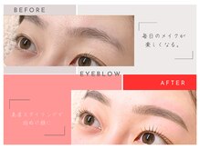 ミメル バイ ラフォンテ(mimelle by LAFONTE)/まゆ毛Wax脱毛before/after