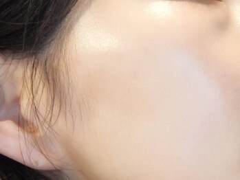 アルティ 福岡大名店(ARTI,)/お悩み解決！水光肌に！