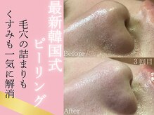 リプラス(Replus)
