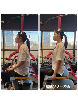 ピーチ(Peach)/筋膜リリース Before＆After