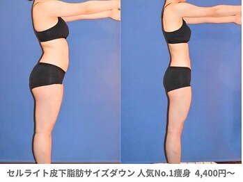 アンシャンテ 芦屋店/下半身痩せ