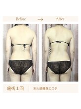 リスキン(Re:Skin)/