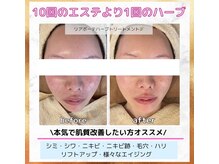 ラウレア(Laule'A)/リアボーテハーブトリートメント