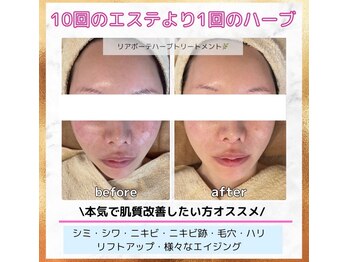 ラウレア(Laule'A)/リアボーテハーブトリートメント