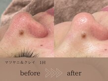 ヴィーヴォ(Vivo)/マツヤニ＆クレイ