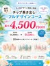 【夏限定キャンペーン】チップ長さ10本　FREE デザイン¥14,000 ー＞￥9,500