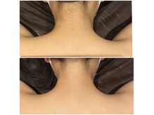 ユジュ(yju)の雰囲気(純国産美肌脱毛機でコラーゲン生成◎(美肌脱毛/VIO/顔脱毛))