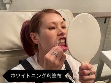 リオッサ オブ ラグーン(RIOSSA of Lagoon)/ホワイト剤を綿棒で歯のみ塗布